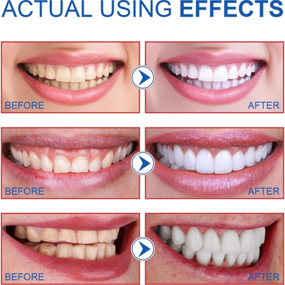 Oralhoe Nicotinamide Dazzle White Toothpaste